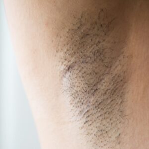 Underarm Hair Removal helping you make an informed decision about which approach might work best